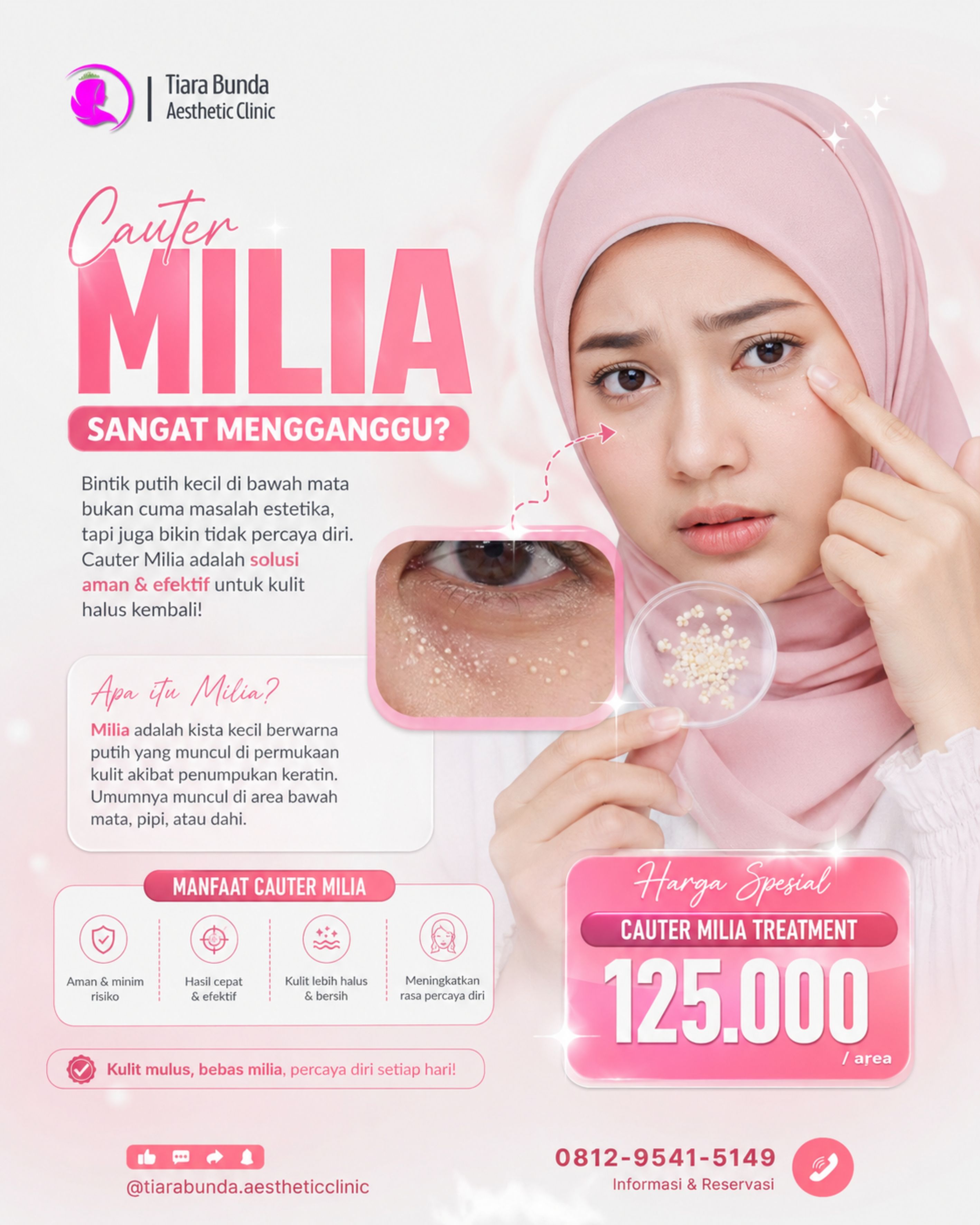 Cauter Milia Treatment